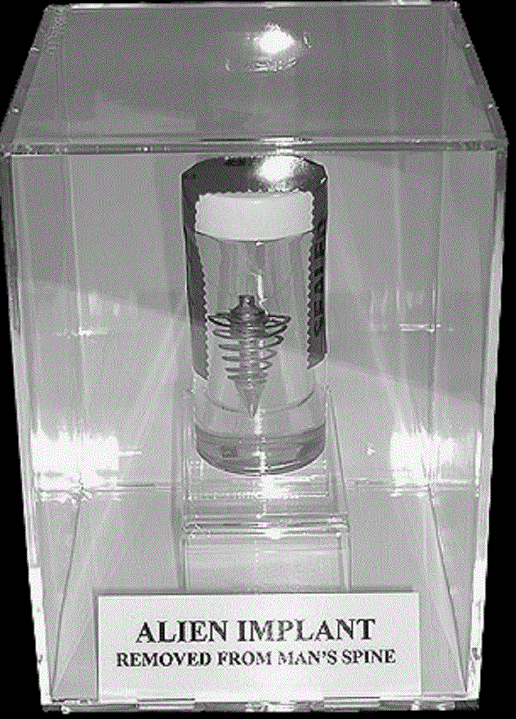 Alien-Implantate-Entferner von 5 Entführten - Freeworldnews.us